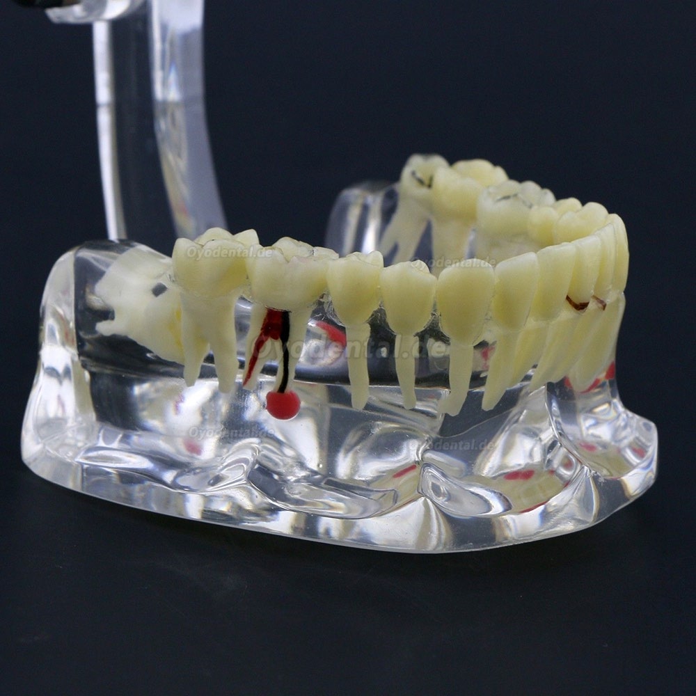 Neue Dental Teach-Studie Allgemeine Erwachsenenpathologie Typodont Zähne Modell # 4001