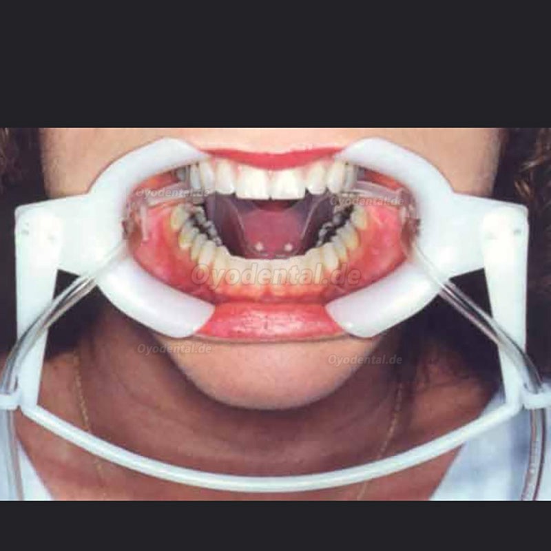 1 Stück Lippen Wangenhalter Zahnarzt mit Sub-Speichel-Saugschlauch Intraoraler Lippen Mund Öffner