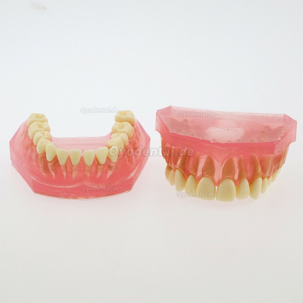 1 Stück Zahnheilkunde Zahnmodell mit 28 Stück abnehmbare Zähne Studie lehren Standardmodell 4004