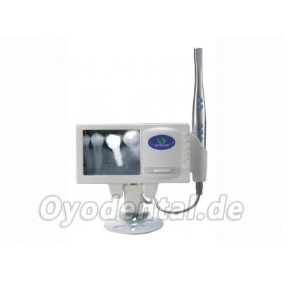 MLG® Dental Intraoral Kamera und Multifunktionalen Röntgenfilmbetrachter M-168 MLG® Dental Intraoral Kamera und Multifunktionalen Röntgenfilmbetrachter M-168