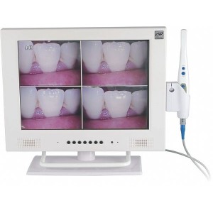 MLG® 15-Zoll-LCD und 1/4 SONY CCD hohe Auflösende Dental Intraoral kamera M-958A