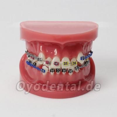 Berichtigung des Zahnes der Zahnheilkunde mit Standard-Modell der Metallhalterung M3005
