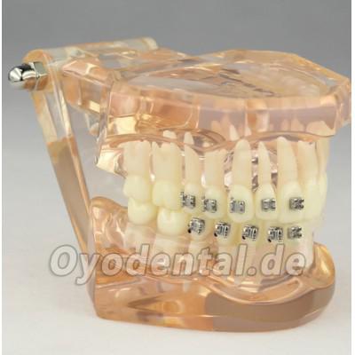 Kieferorthopädisches Demonstrationsmodell der Zahnheilkunde mit den keramischen Halterungen M3009