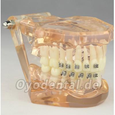 Kieferorthopädisches Demonstrationsmodell der Zahnheilkunde mit den keramischen Halterungen M3009 Kieferorthopädisches Demonstrationsmodell der Zahnheilkunde mit den keramischen Halterungen M3009