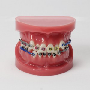 Berichtigung des Zahnes der Zahnheilkunde mit Standard-Modell der Metallhalterung M3005