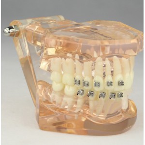 Kieferorthopädisches Demonstrationsmodell der Zahnheilkunde mit den keramischen Halterungen M3009