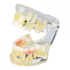 Kinder's Laubabwerfende Zahn Verlust Demonstration Zahnmedizinische Lehre Modell 7019