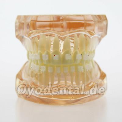 Dental Kieferorthopädie Behandlung Modell Demo Zähne Keramikbrackets # 3002