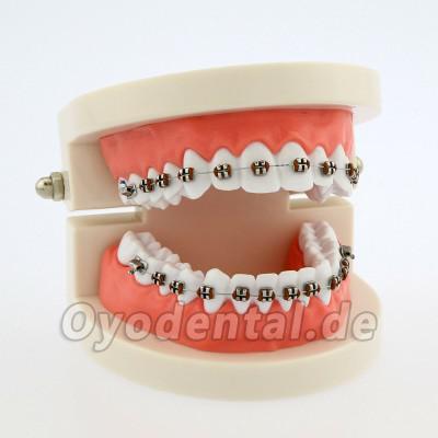 Dental Teach Typodont Demonstrationszahnmodell mit Zahnspangen Für die Patientenstudie 5006