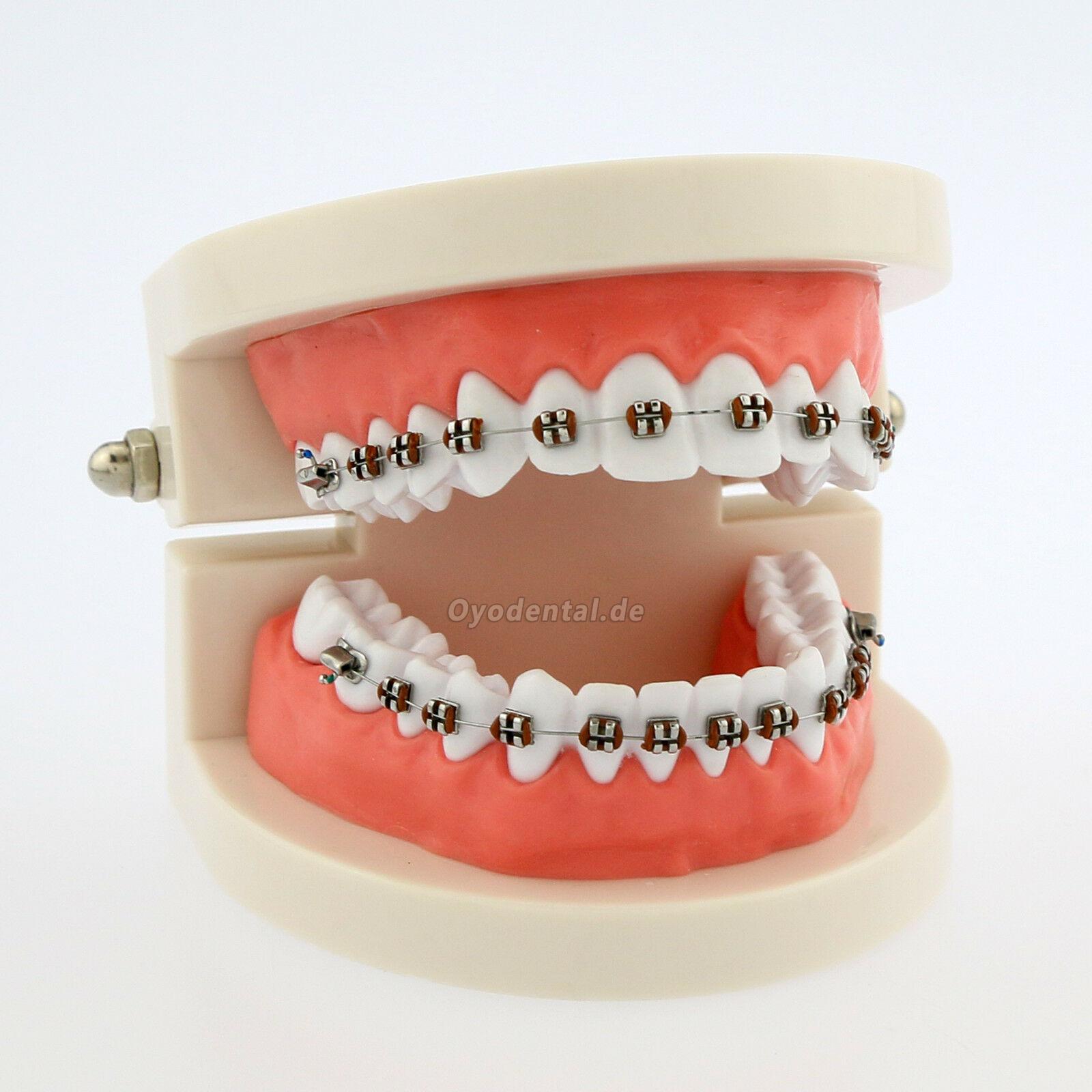Modello di denti Typodont ortodontico dentale con staffe metalliche con lacci di legatura