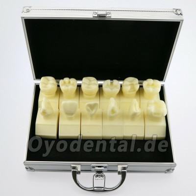 Dental 4-fach Kavitätenpräparationsstudie Modell # 7009 01