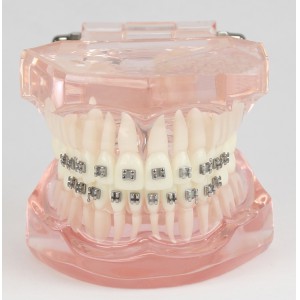 Dental Kieferorthopädie Behandlung Modell Demo Zähne MetallbracketsModel M3001
