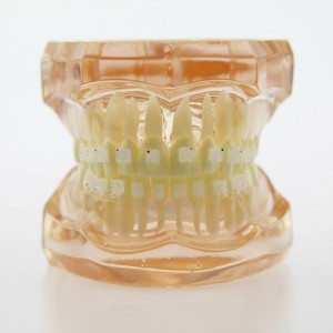 Dental Kieferorthopädie Behandlung Modell Demo Zähne Keramikbrackets # 3002