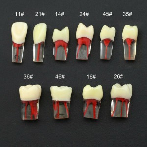 Dental RCT Endo Praxis Typodont Zähne kompatibel mit Kilgore Nissin