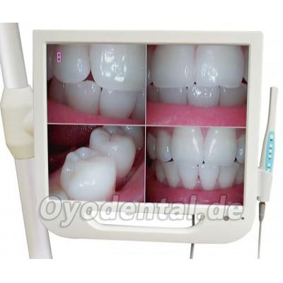 17-Zoll-High-Definition-Digital-LCD-AIO-Monitor Dental Intraorale Kamera 17-Zoll-High-Definition-Digital-LCD-AIO-Monitor Dental Intraorale Kamera