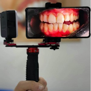 Dental Anpassung Fotografie Blitzlicht Handy Oral Photography Fülllicht