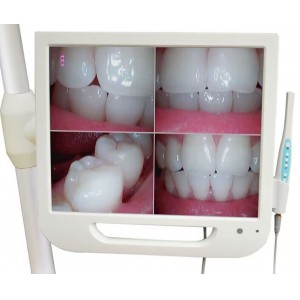 17-Zoll-High-Definition-Digital-LCD-AIO-Monitor Dental Intraorale Kamera