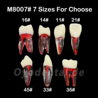 10 Stücke Dental Endodontie Wurzelkanal Praxis Endo Zähne Modell