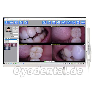 Magenta YF-2400P 24-Zoll-Touchscreen-Intraoralkamera mit LCD-Monitor und WLAN-Funktion