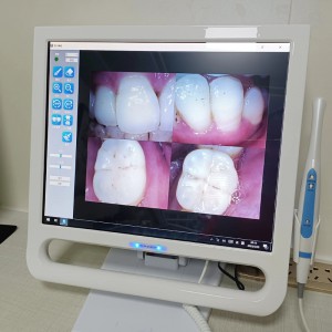 YF-1700P+ 17-Zoll Dental-Intraoralkamera Touch LCD-Bildschirm für Dentaleinheit mit Halterung