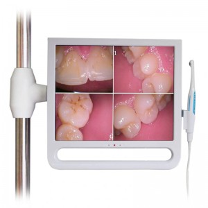 YF1700M 17-Zoll Dental Intraoralkamera mit Monitor und Halterung 1024 x 768 Pixel