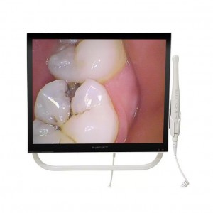 Magenta YFHD-D Dentale Intraoralkamera 1/4 Sony CCD 17-Zoll-Monitor und Stützarmhalterung