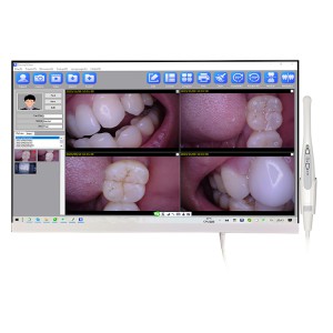 Magenta YF-2400P 24-Zoll-Touchscreen-Intraoralkamera mit LCD-Monitor und WLAN-Funktion
