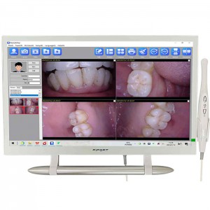 Magenta YF-2200P+21,5-Zoll-LCD-Monitor Touchscreen Intraoralkamera VGA + HDMI