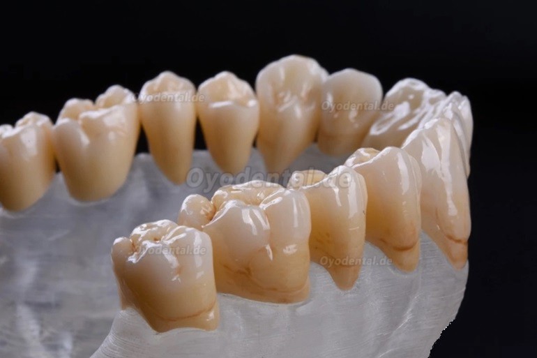 1 Stück 3D Dentallabor Mehrschichtiger Zirkon Ronden CAD/CAM-Keramikblock