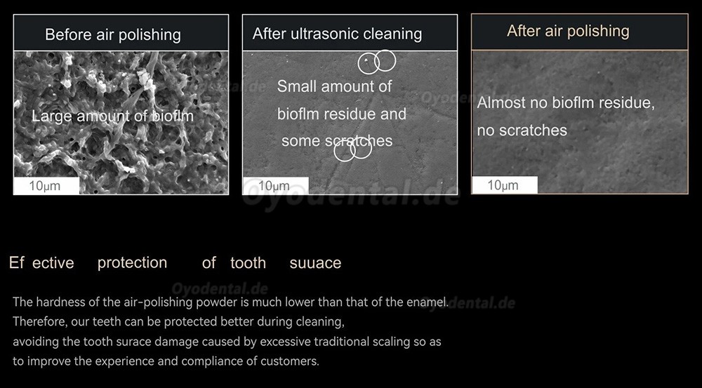 Woodpecker AP-H Plus Airflow Pulverstrahlger&auml;t Prophylaxe Handst&uuml;ck supragingival / subgingival