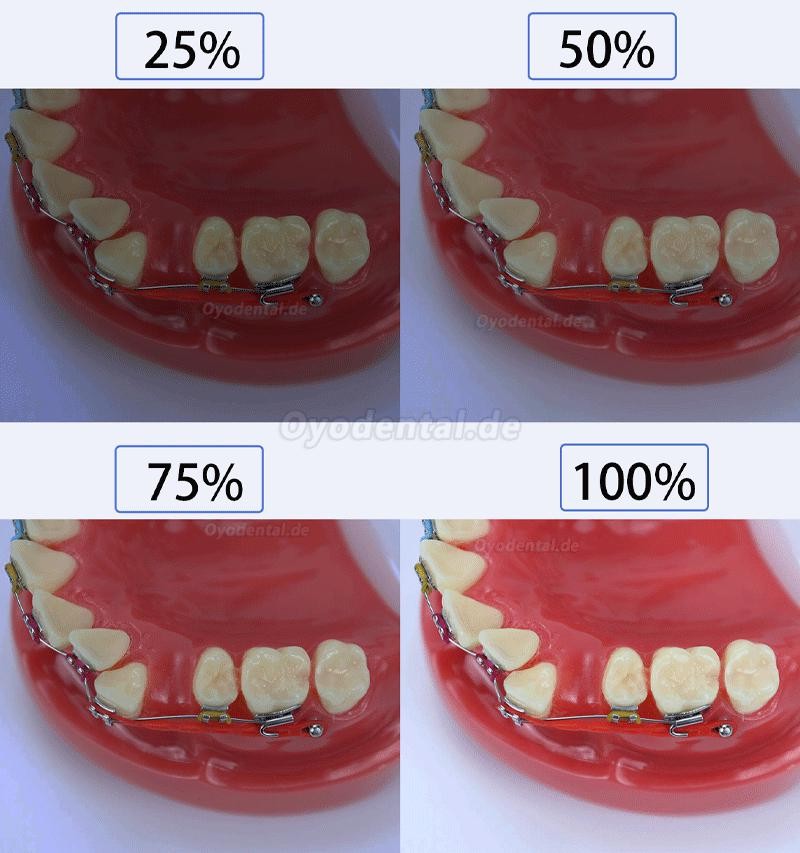 Dental Anpassung Fotografie Blitzlicht Handy Oral Photography Fülllicht