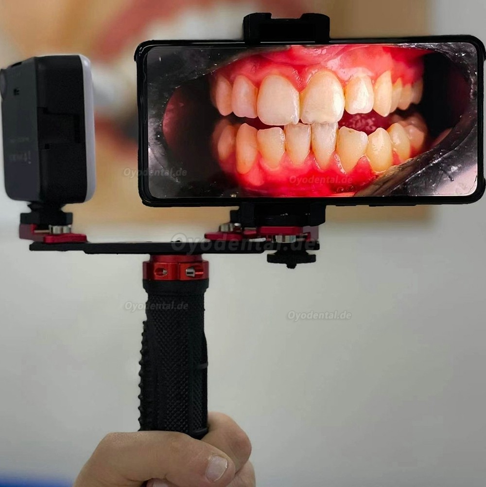 Dental Anpassung Fotografie Blitzlicht Handy Oral Photography Fülllicht