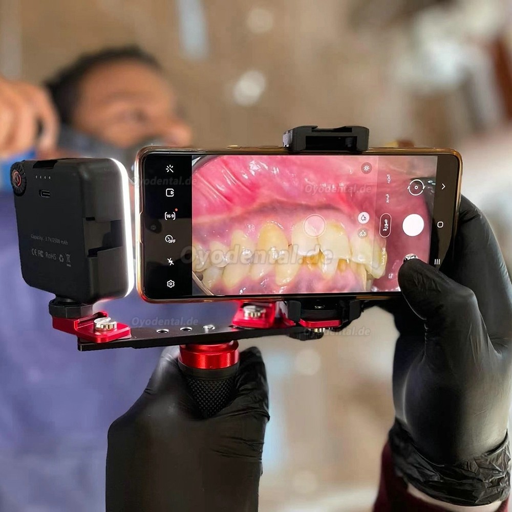 Dental Anpassung Fotografie Blitzlicht Handy Oral Photography Fülllicht