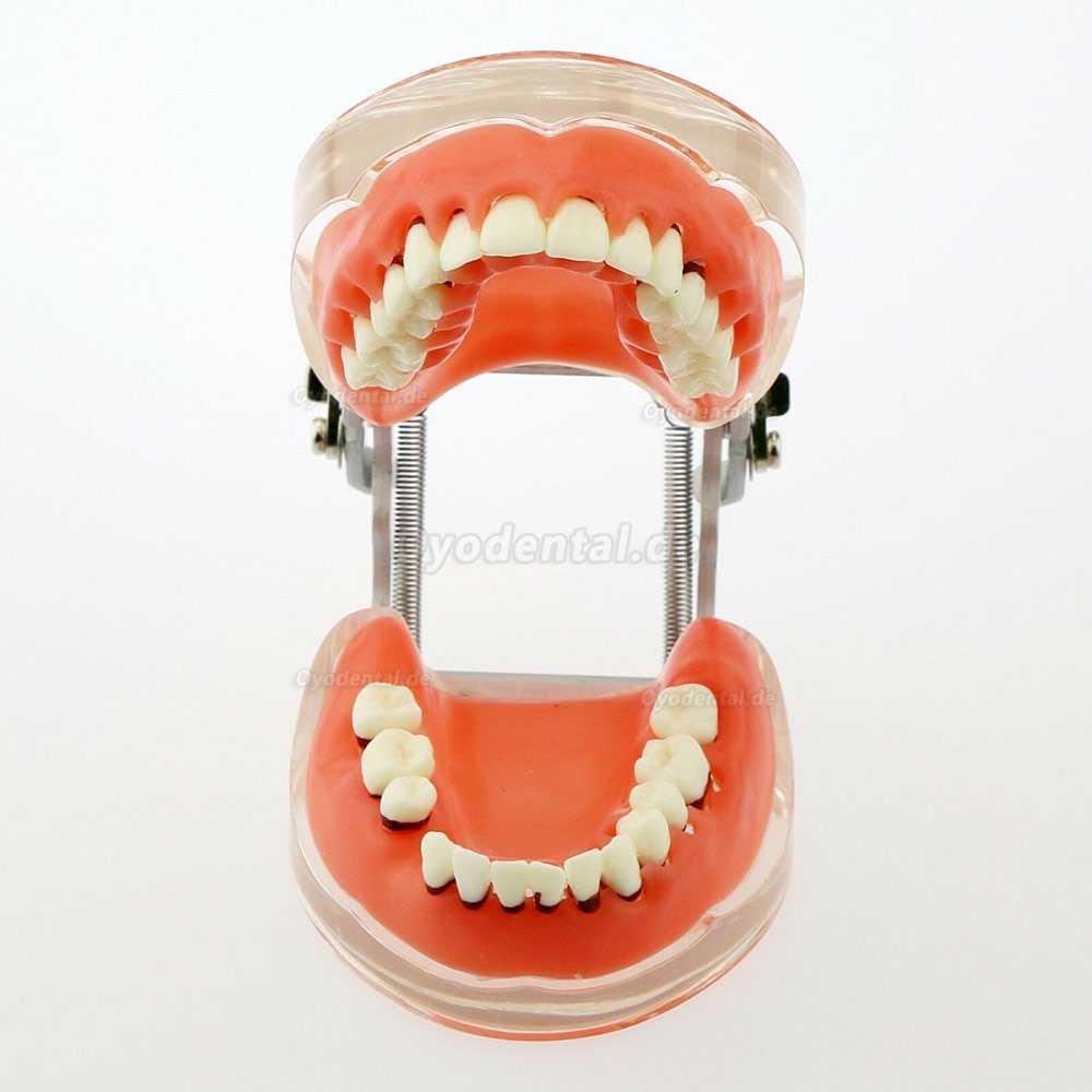 Dentalmodell Erwachsene Pathologische Parodontitis Studienzähne Modell 4017