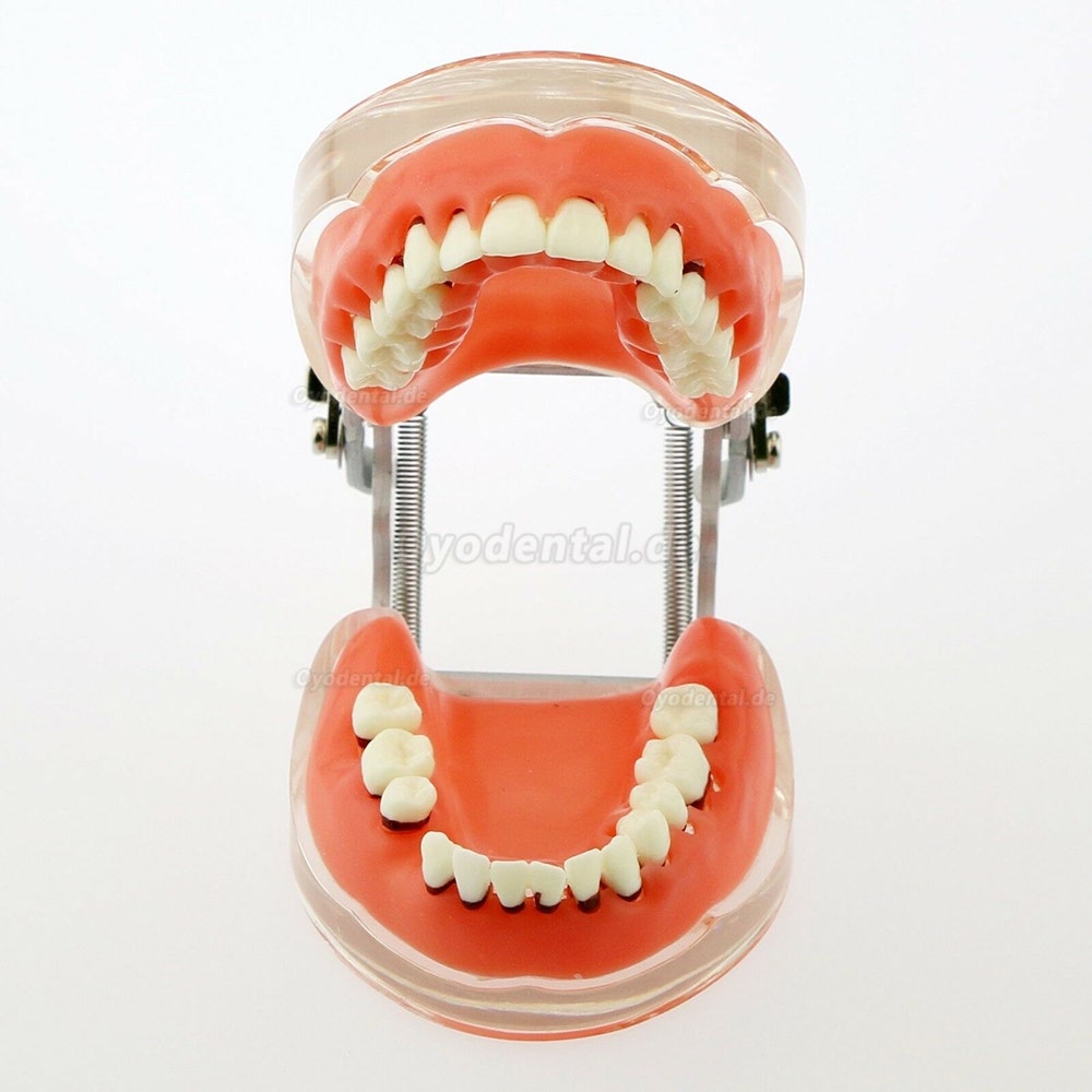 Dentalmodell Erwachsene Pathologische Parodontitis Studienzähne Modell 4017