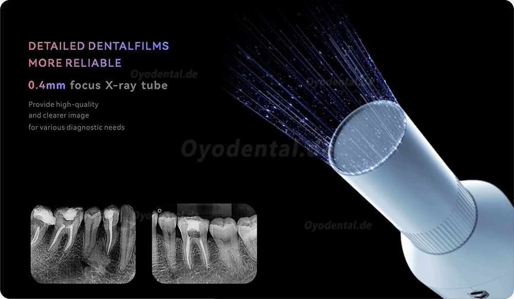 Woodpecker Ai Ray Touch-Screen Tragbares Dental-Röntgengerät Konstante DC-Hochfrequenz