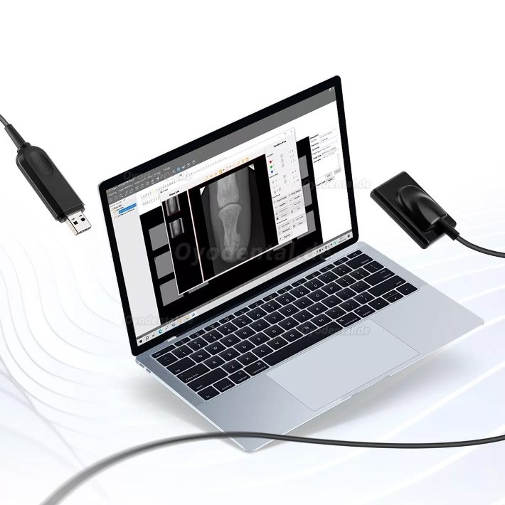 Tragbares Dentalröntgengerät mit intraoralem RVG-Röntgensensor-Kit