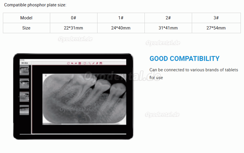 Runyes DS630 PSP Scanner digitales dentales R&ouml;ntgensystem f&uuml;r Speicherfolien