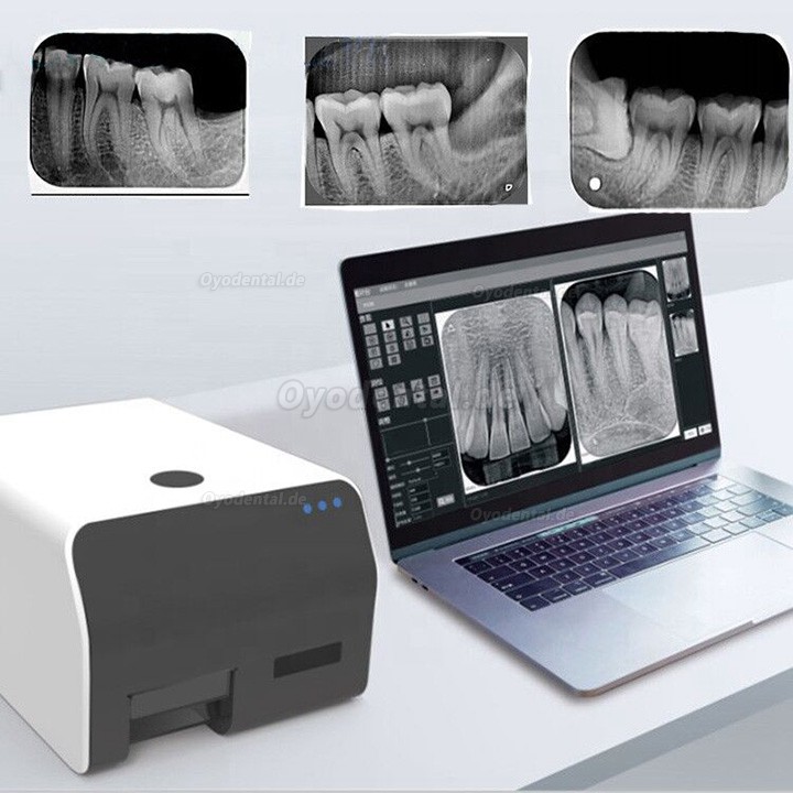 VRN Dental Intraorales Röntgen Speicherfolienscanner Speicherfolien Scanner Röntgenscanner Zahnmedizin