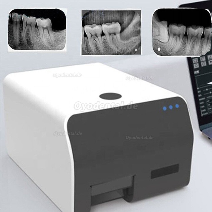 VRN Dental Intraorales Röntgen Speicherfolienscanner Speicherfolien Scanner Röntgenscanner Zahnmedizin