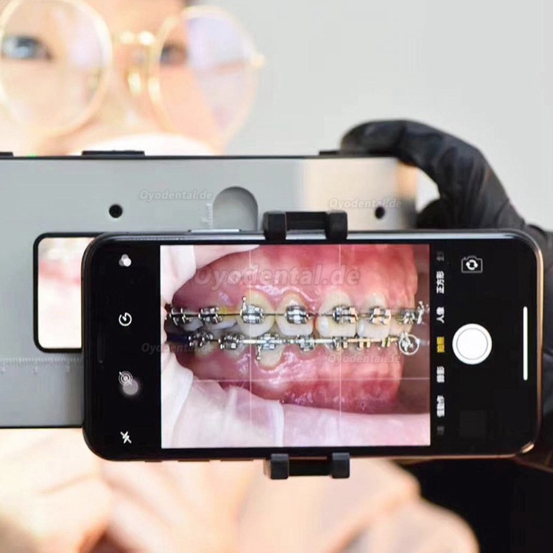 Tragbare Dentalfotografie Fülllicht Handy Taschenlampe Oral LED Fülllicht