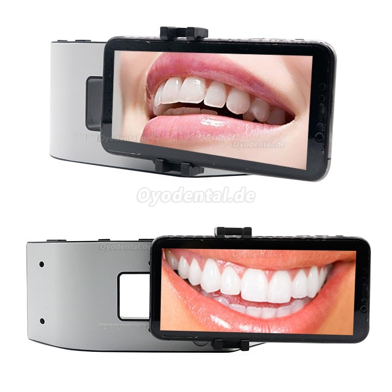 Tragbare Dentalfotografie Fülllicht Handy Taschenlampe Oral LED Fülllicht