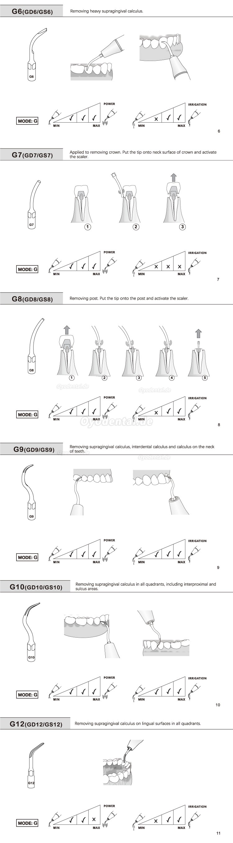 10 Stück Ultraschall Spitzen G1 G2 G3 G4 G5 G6 GD1 GD2 GD3 GD4 GD5 GD6 Kompatibel mit EMS Woodpecker