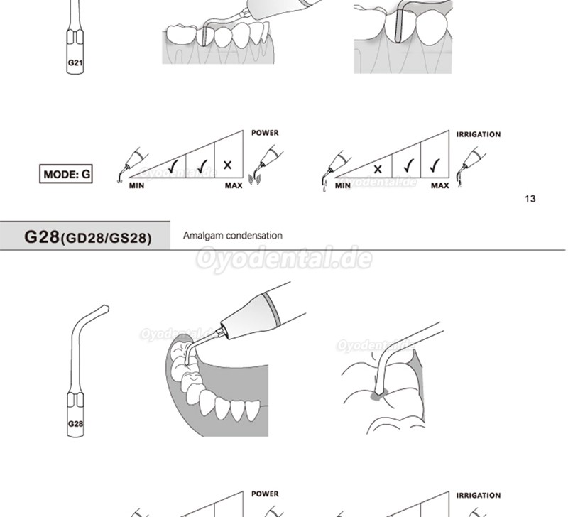 5 Stück G20 G21 G30 G31 G32 G33 G35 Ultraschallspitzen Kompatibel mit REFINE EMS Woodpecker Ultraschall Handstück