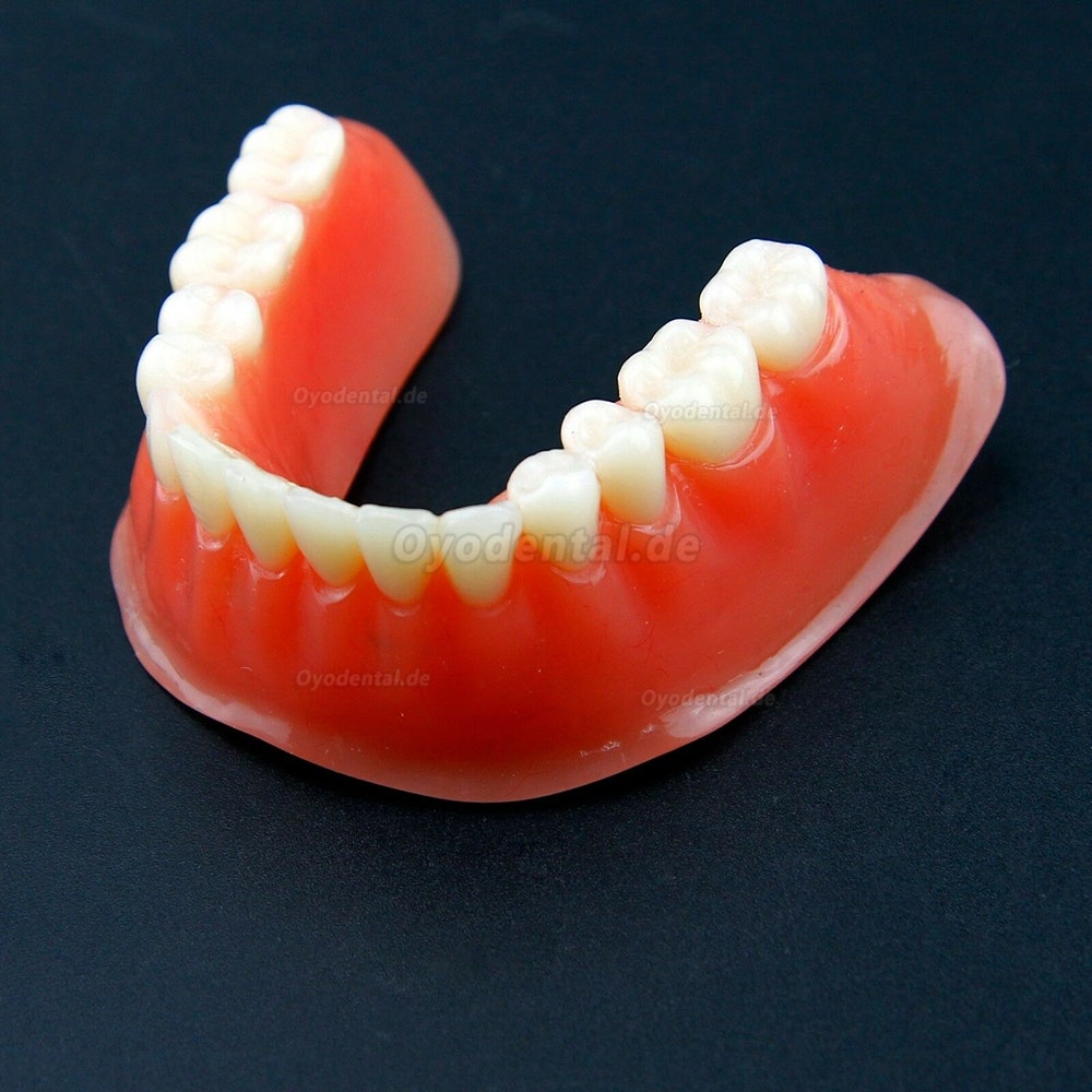 Dental Overdenture Typodont Modell Minderwertiges Präzisionsimplantat Golden 6009