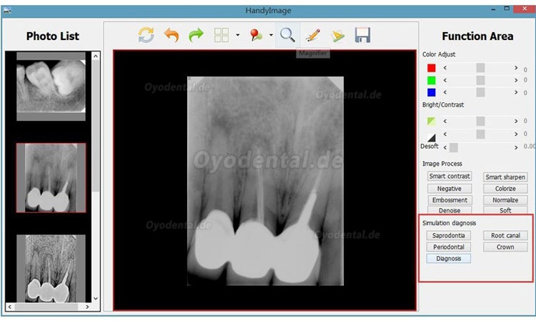 HDR 500 Dental Röntgensensoren für Zahnärzte USB Digitale Handliches System
