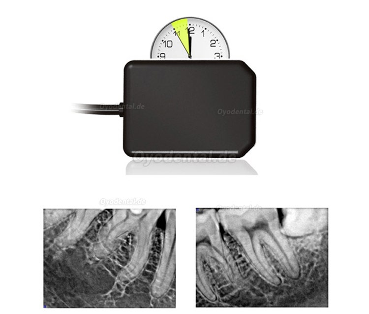 HDR 500 Dental Röntgensensoren für Zahnärzte USB Digitale Handliches System HDR 500 Dental Röntgensensoren für Zahnärzte USB Digitale Handliches System