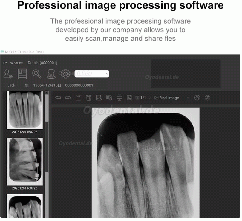Handy IPS3 dentaler digitaler PSP-R&ouml;ntgenscanner f&uuml;r Speicherfolien
