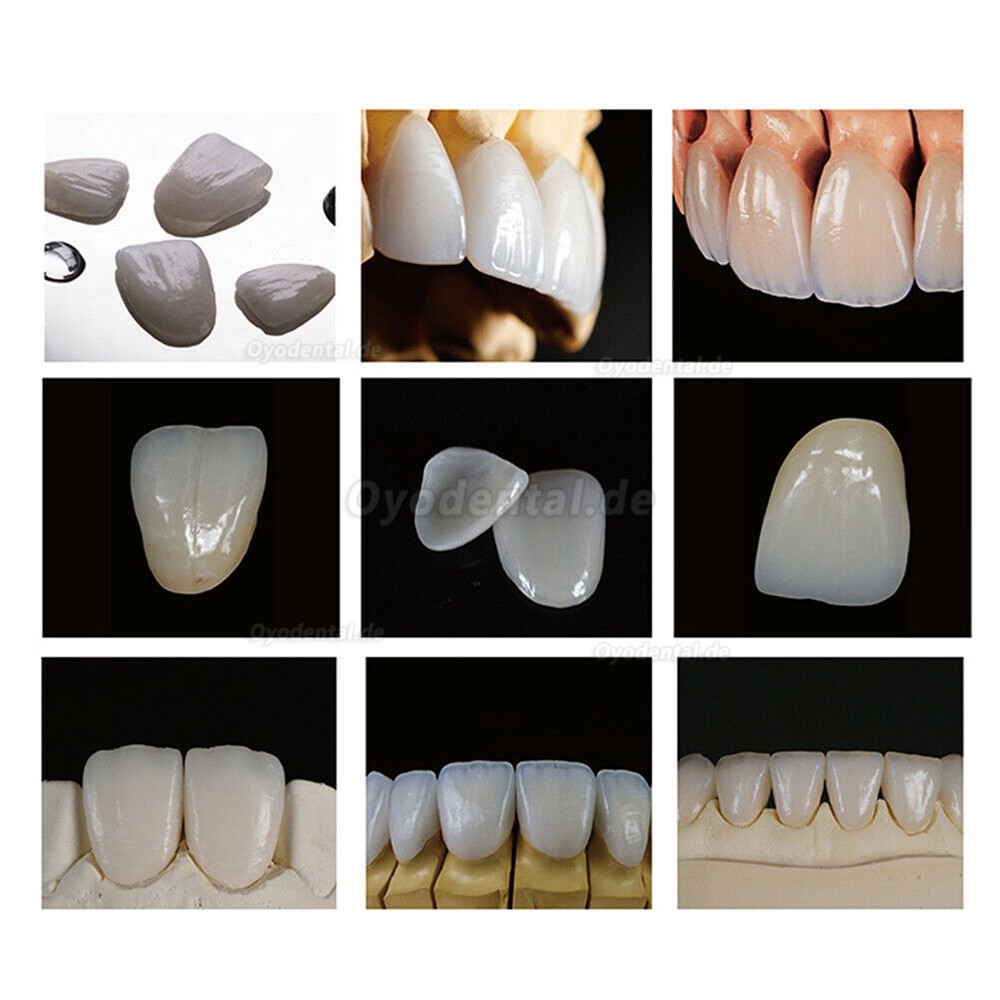 4 Stücke B40 Lithiumdisilikatkeramik Rohlinge E-max HT/LT Cad Cam Ronden Für Sirona Cerec