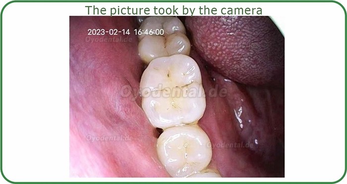 Dental Wireless WiFi Oral Intraoralkamera für Mobiltelefon und iPad